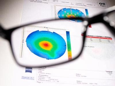 Quy trình 8 bước cá nhân hóa tại Ortho-K Việt